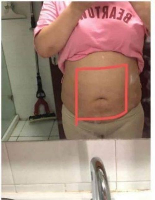 �й���ҽ��ϯר�ҡ����Ƴ���