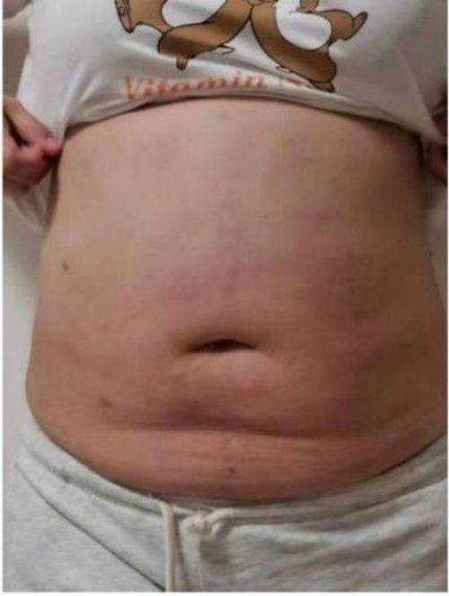 �й���ҽ��ϯר�ҡ����Ƴ���