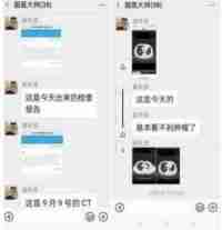 中国著名针灸专家治疗肿瘤第 一 人——陈吉香