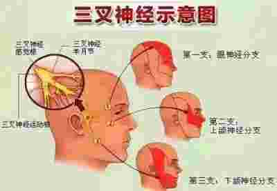 中国好医生—蒋学林 三叉神经痛就服全蝎蜈蚣多肽