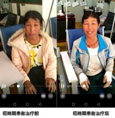 各种癌症先治好病才收治疗费10万元打底