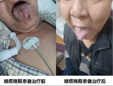 各种癌症先治好病才收治疗费10万元打底