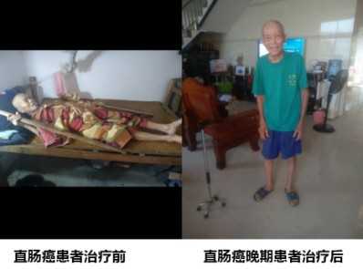 各种癌症先治好病才收治疗费10万元打底