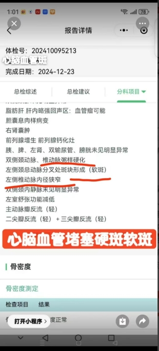 梅山医痴刘建清，心脑血管秘方创始传承人