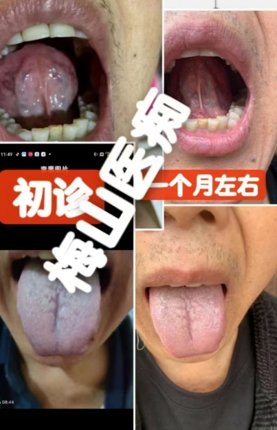 梅山医痴刘建清，心脑血管秘方创始传承人