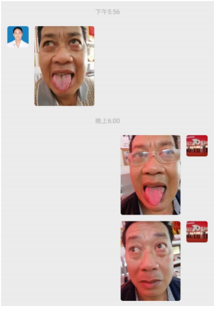 广西中医特色疗法传承导师——梁爱瑟