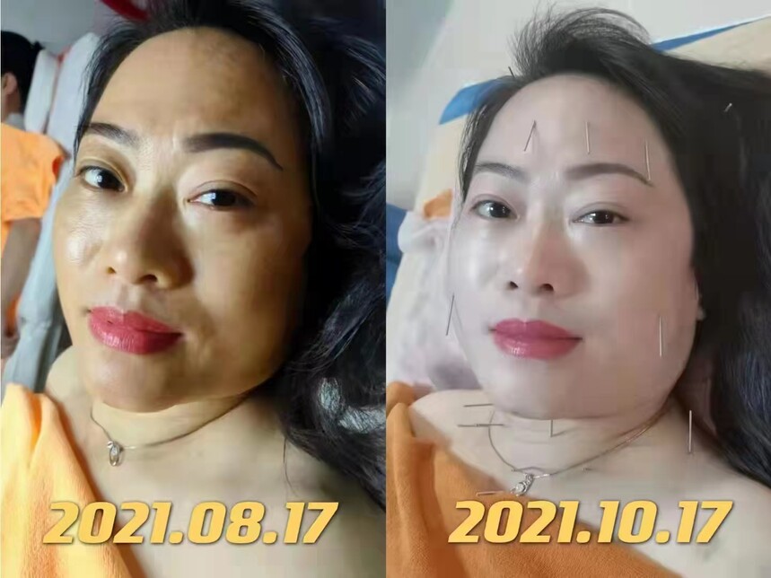 最美名中医—— 施发兴