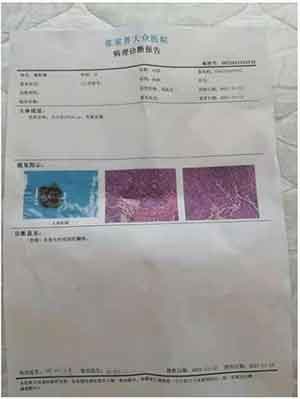 彰显中国榜样 时代楷模 中国著名针灸专家 治疗肿瘤第一人——陈吉香